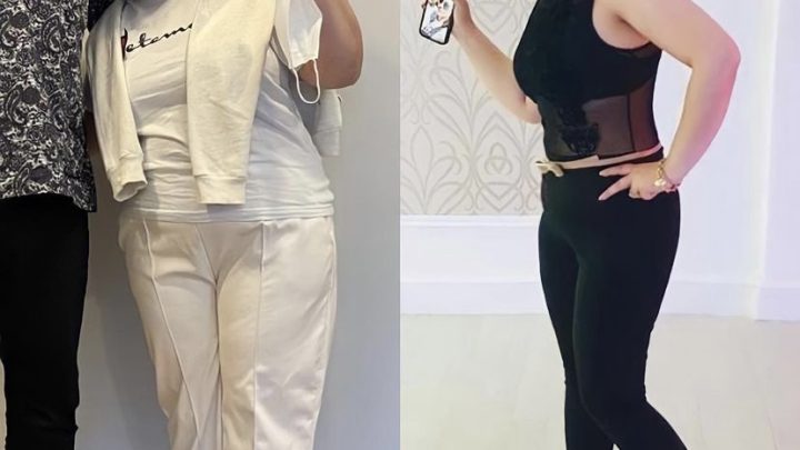 The Turkish Secret to Affordable Weight Loss Surgery